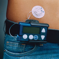 Insulin-Pump